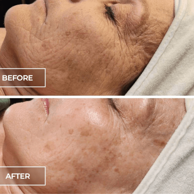 Skin Revival Series at Crush Theory Beauty Co in OKC, OK